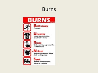 Burns
 