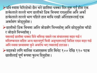 यमद स्वास फेरररहेको छैन िने छामतिा धक्का मदन सुरू गनुघ होस एक
हत्केलाले तल्लो िाग छातीको मठक मिचिा राख्नुहोस अमन अको
हत्केलाले तल्लो िाग पमहले हात िामथ राखी औांलाहरूलाइघ एक
अकाघसांग जोड्नुहोस ।
छातीको मठक मिचिा अमल जोडसाँग मथच्नहोस् अमन छोड्नुहोस चााँडो
र जोडले मथच्नहोस् ।
यसलाइघ छातीिा धक्का मदने िमनन्छ यसले रक्त सांचालनिा िद्दत गछघ र
िमस्ततकघात समहत अन्य िहत्वपूणघ मििी अङ्गहरूलाइघ मजमवत राख्न िद्दत गछघ
अमन स्वास प्रस्वासिा कुने अवरोध िए त्यसलाइघ हटाउछ ।
िद्दतको लमग िामनस नआएसम्ि प्रमत मिनेट १०० देमख १२० पटक
छातीलाइघ पूणघ रूपिा फुल्न मदनुहोस ।
 