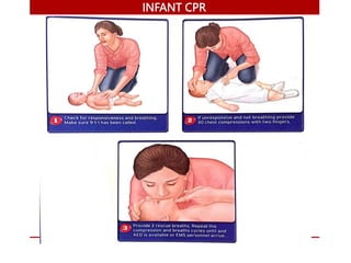 INFANT CPR
 
