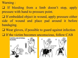 Warning :
❑ If bleeding from a limb doesn’t stop, apply
pressure with hand to pressure point.
❑ If embedded object in wound, apply pressure either
side of wound and place pad around it before
bandaging.
❑ Wear gloves, if possible to guard against infection
❑ If the victim becomes unconscious, follow CAB
 