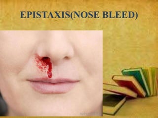 EPISTAXIS(NOSE BLEED)
 