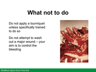 What not to do
Stratford Upon Avon First Aid
Do not apply a tourniquet
unless specifically trained
to do so
Do not attempt to wash
out a major wound – your
aim is to control the
bleeding
 