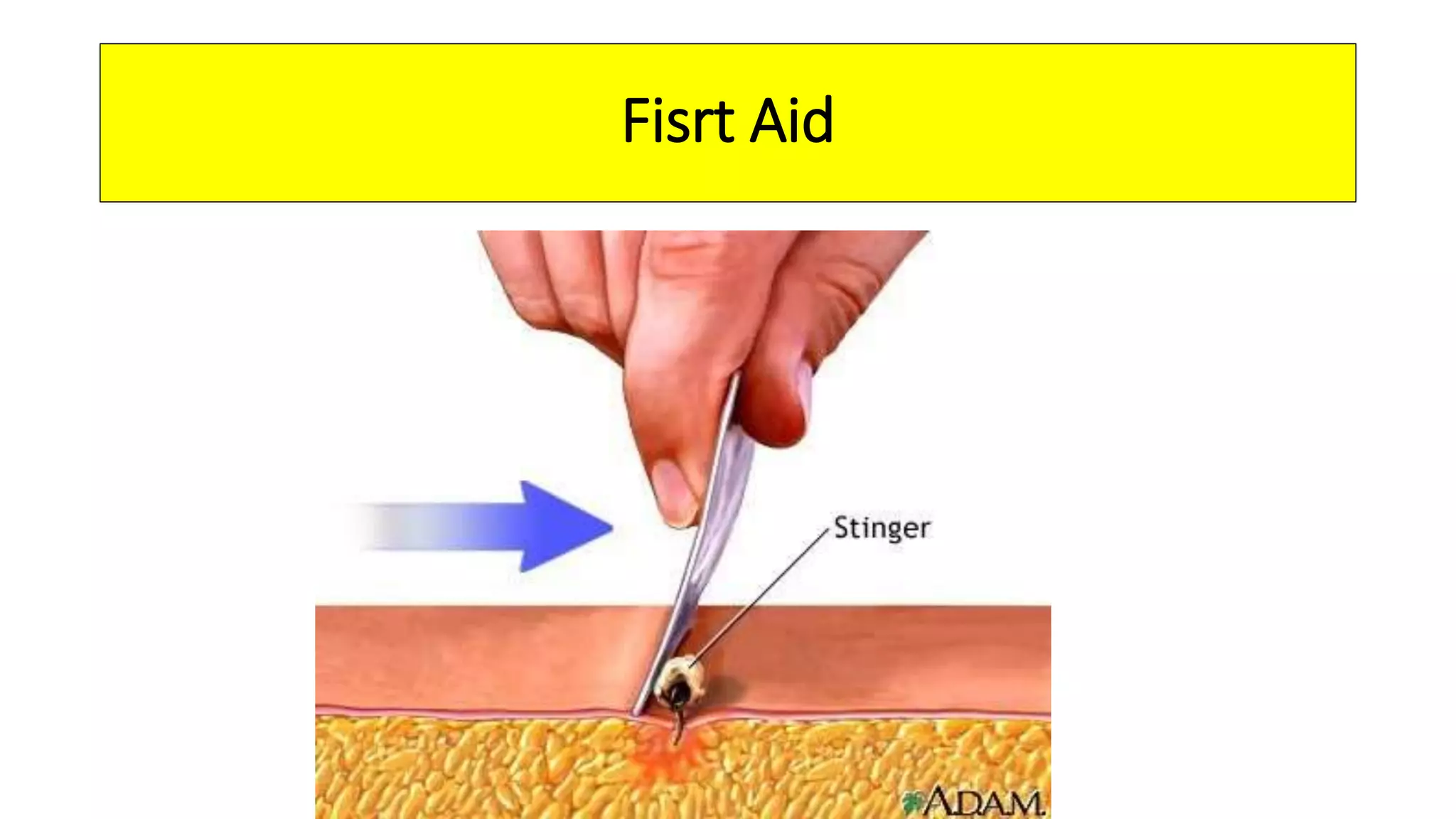 First Aid For Common Injuries PPTX first-aid-for-common-injuries-pptx