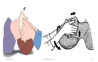 8/26/2023 BY: MEAZA LEMA 30
 