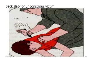 8/26/2023 BY: MEAZA LEMA 72
Back slab for unconscious victim
 