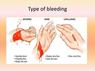 Bleeding Sources First aid for patients with Wound, Hemorrhage.pptx