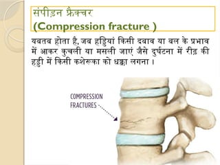 संपीड़न फ्रै क्चर
(Compression fracture )
यबतब होता है, जब हड्डियां किसी दबाव या बल के प्रभाव
में आकर कुचली या मसली जाएं जैसे दुर्घटना में रीढ़ की
हड्डी में किसी कशेरूका को धक्का लगना ।
 