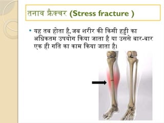 तनाव फ्रै क्चर (Stress fracture )
 यह तब होता है, जब शरीर की किसी हड्डी का
अधिकतम उपयोग किया जाता है या उससे बार-बार
एक ही गति का काम किया जाता है।
 