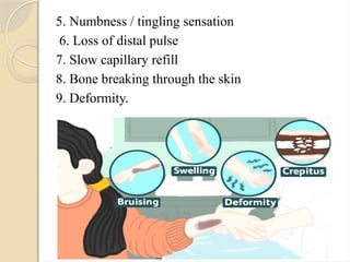 5. Numbness / tingling sensation
6. Loss of distal pulse
7. Slow capillary refill
8. Bone breaking through the skin
9. Deformity.
 