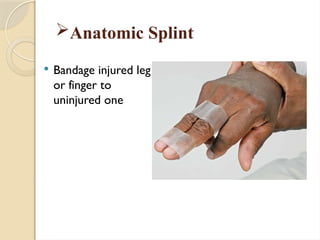 Anatomic Splint
 Bandage injured leg
or finger to
uninjured one
 