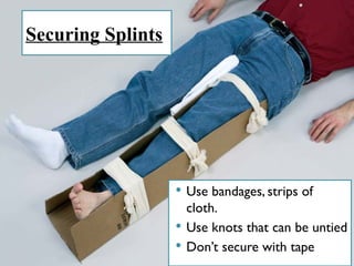Securing Splints
 Use bandages, strips of
cloth.
 Use knots that can be untied
 Don’t secure with tape
 