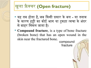 खुला फ्रै क्चर (Open fracture)
 यह तब होता है, जब किसी प्रकार के बल - या तनाव
के कारण हड्डी का कोई भाग या टुकड़ा त्वचा के अंदर
से बाहर निकल जाता है।
 Compound fracture, is a type of bone fracture
(broken bone) that has an open wound in the
skin near the fractured bone.
 