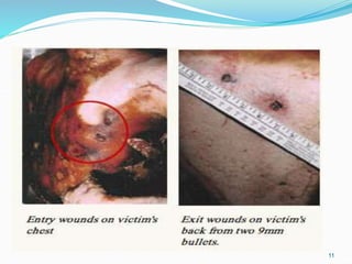 Perforating Gunshots
11
 