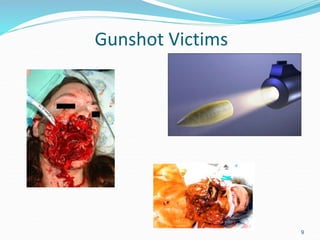 Gunshot Victims
9
 