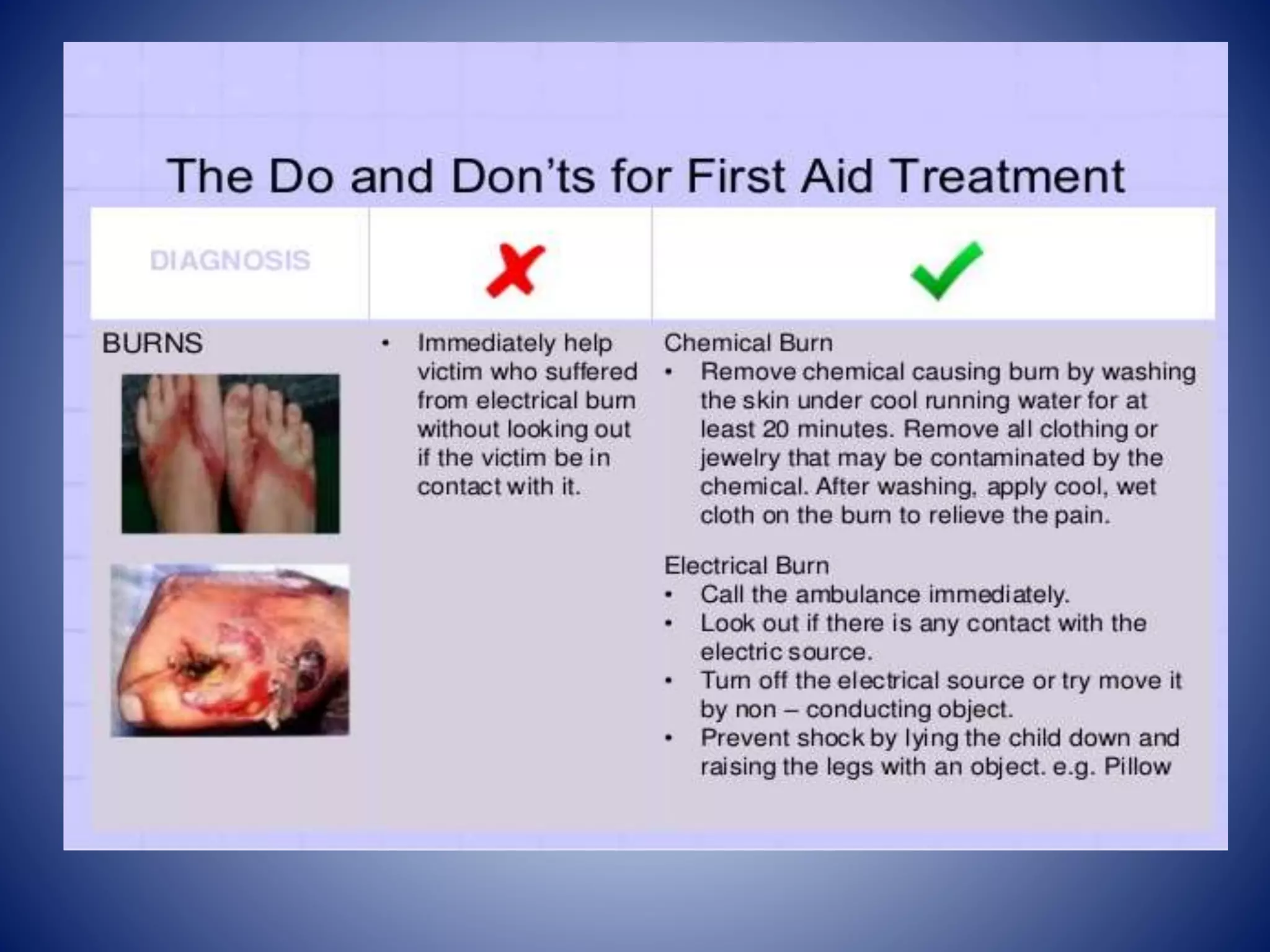 First aid in burns and scalds | PPTX