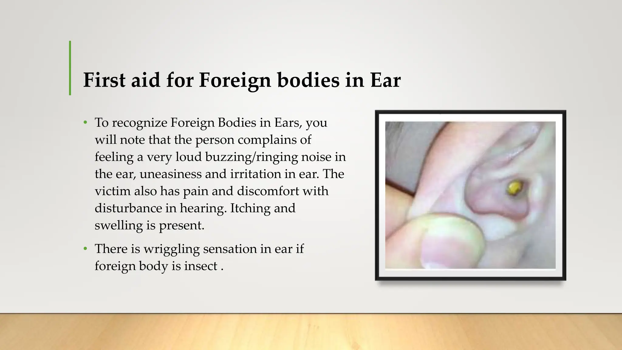 First aid in Foreign bodies Skin, Eye, Ear Nose Throat.pptx