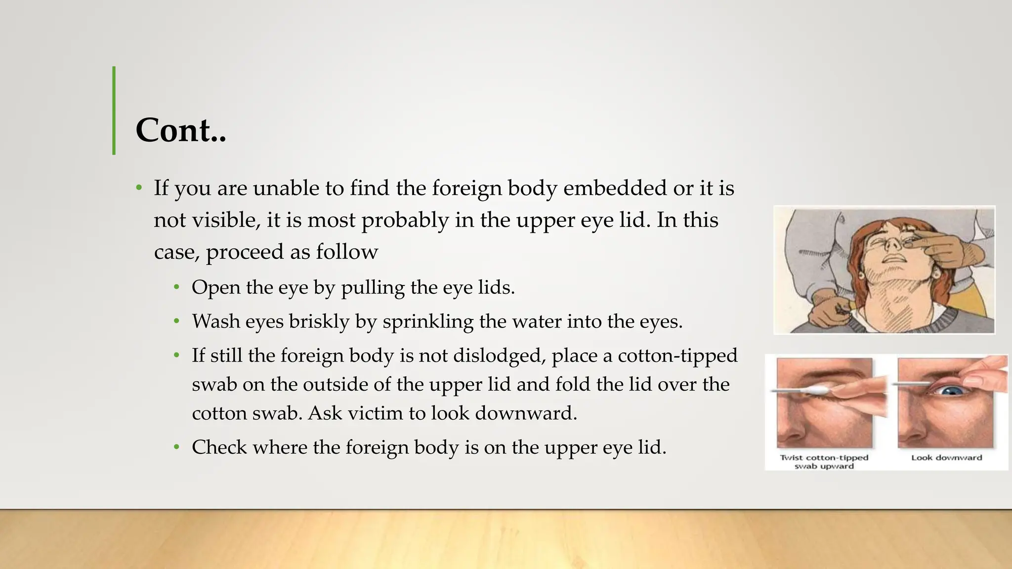First aid in Foreign bodies Skin, Eye, Ear Nose Throat.pptx