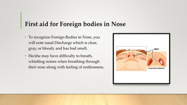 First aid in Foreign bodies Skin, Eye, Ear Nose Throat.pptx