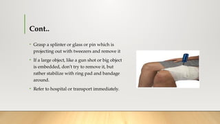 First aid in Foreign bodies Skin, Eye, Ear Nose Throat.pptx