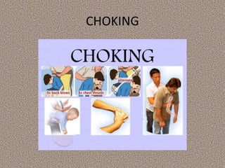 CHOKING
 
