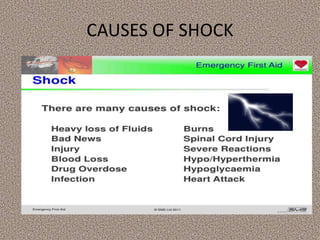 CAUSES OF SHOCK
 