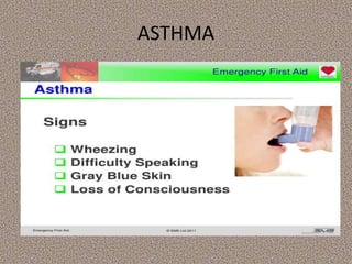 ASTHMA
 