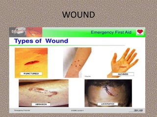 WOUND
 