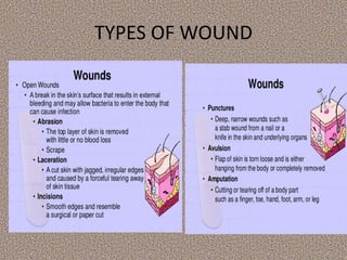 TYPES OF WOUND
 