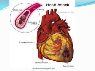 vijayakumarblathur@gmail.com
 