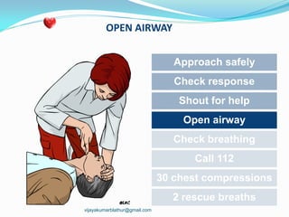 OPEN AIRWAY
Approach safely
Check response
Shout for help
Open airway
Check breathing
Call 112
30 chest compressions
2 rescue breaths
vijayakumarblathur@gmail.com
 