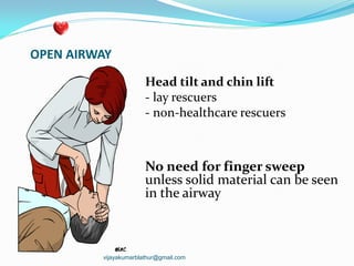 OPEN AIRWAY
Head tilt and chin lift
- lay rescuers
- non-healthcare rescuers
No need for finger sweep
unless solid material can be seen
in the airway
vijayakumarblathur@gmail.com
 