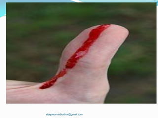 vijayakumarblathur@gmail.com
 