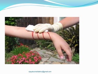 vijayakumarblathur@gmail.com
 