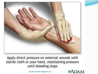 vijayakumarblathur@gmail.com
 