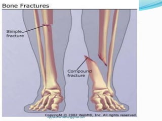 vijayakumarblathur@gmail.com
 