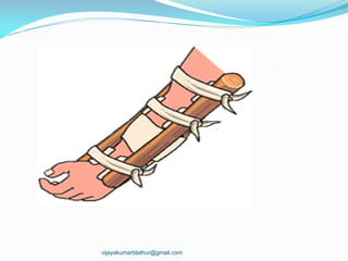 vijayakumarblathur@gmail.com
 