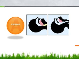 AIRWAY
 
