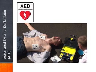 Automated
External
Defibrillator
(AED)
 
