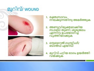 മുറിവ്/ WOUND
1. രക്തപ്സാവ്ം
നിലക്കുന്നതിനു അമര്‍ത്തുക
2. അണുവ്ിമുക്തമാക്കിയ
സവാബ്/ തുണി, ശുദ്ധജലം
എന്നിവ് ഉെണ്യാഗ്ിച്ച്
വ്ൃതിയാക്കുക
3. പെവൈല്‍ പ്രസ്ിംഗ്്/
ബാന്‍ര് എയിര്
4. മുൈിവ്് െറ്റിയ ഭാഗ്ം ഉയര്‍ത്തി
വ്യ്ക്കുക
 