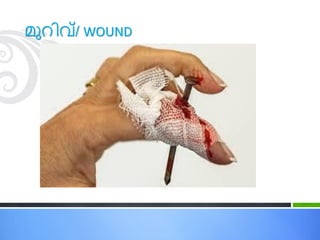 മുറിവ്/ WOUND
 