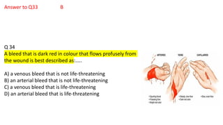 Answer to Q33 B
Q 34
A bleed that is dark red in colour that flows profusely from
the wound is best described as:…..
A) a venous bleed that is not life-threatening
B) an arterial bleed that is not life-threatening
C) a venous bleed that is life-threatening
D) an arterial bleed that is life-threatening
 