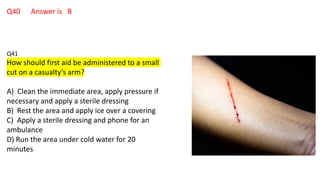 Q40 Answer is B
Q41
How should first aid be administered to a small
cut on a casualty’s arm?
A) Clean the immediate area, apply pressure if
necessary and apply a sterile dressing
B) Rest the area and apply ice over a covering
C) Apply a sterile dressing and phone for an
ambulance
D) Run the area under cold water for 20
minutes
 