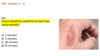 Q41 Answer is A
Q42
A burn should be cooled for at least how
many minutes?
a) 2 minutes
b) 5 minutes
c) 20 minutes
d) 15 minutes
 