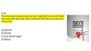 Q 58
You come upon a person who has lost a significant amount of blood,
has a very pale skin color, and is confused. What do you suspect the
cause to be
a) Seizure
b) Stroke
c) Low blood sugar
d) Shock
 
