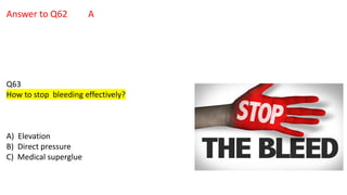 Answer to Q62 A
Q63
How to stop bleeding effectively?
A) Elevation
B) Direct pressure
C) Medical superglue
 