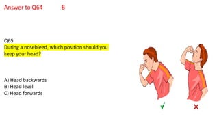 Answer to Q64 B
Q65
During a nosebleed, which position should you
keep your head?
A) Head backwards
B) Head level
C) Head forwards
 