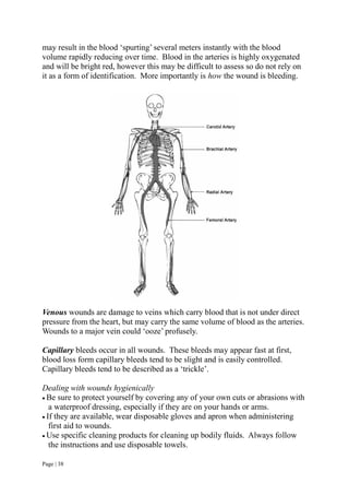 Page | 38
may result in the blood ‘spurting’ several meters instantly with the blood
volume rapidly reducing over time. Blood in the arteries is highly oxygenated
and will be bright red, however this may be difficult to assess so do not rely on
it as a form of identification. More importantly is how the wound is bleeding.
Venous wounds are damage to veins which carry blood that is not under direct
pressure from the heart, but may carry the same volume of blood as the arteries.
Wounds to a major vein could ‘ooze’ profusely.
Capillary bleeds occur in all wounds. These bleeds may appear fast at first,
blood loss form capillary bleeds tend to be slight and is easily controlled.
Capillary bleeds tend to be described as a ‘trickle’.
Dealing with wounds hygienically
 Be sure to protect yourself by covering any of your own cuts or abrasions with
a waterproof dressing, especially if they are on your hands or arms.
 If they are available, wear disposable gloves and apron when administering
first aid to wounds.
 Use specific cleaning products for cleaning up bodily fluids. Always follow
the instructions and use disposable towels.
 