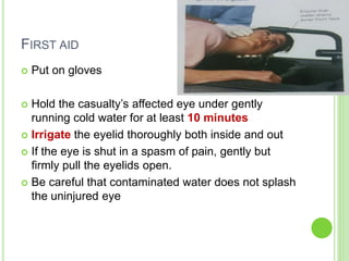 FIRST AID
 Put on gloves
 Hold the casualty’s affected eye under gently
running cold water for at least 10 minutes
 Irrigate the eyelid thoroughly both inside and out
 If the eye is shut in a spasm of pain, gently but
firmly pull the eyelids open.
 Be careful that contaminated water does not splash
the uninjured eye
 