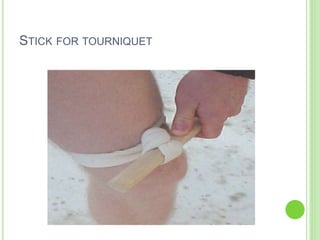STICK FOR TOURNIQUET
 