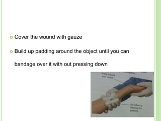  Cover the wound with gauze
 Build up padding around the object until you can
bandage over it with out pressing down
 